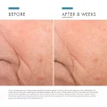 SkinCeuticals Triple Lipid Restore 2:4:2 Anti-Aging Lipid Cream 48ml 8