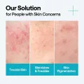MEDIHEAL Madecassoside Blemish Repair Serum with 2% Niacinamide, 40ml 4