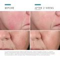 SkinCeuticals Phyto Corrective Essence Mist - Soothing Hydration 50ml 9