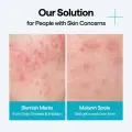 MEDIHEAL Madecassoside Wrapping Serum Mask - Calming & Blemish Care (10 Count) 7