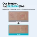 MEDIHEAL Madecassoside Wrapping Serum Mask - Calming & Blemish Care (10 Count) 8