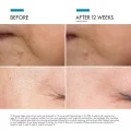 SkinCeuticals P-TIOX Anti-Wrinkle Peptide Serum - 30ml Expression Line Care 4