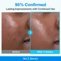 NUMBUZIN No. 3 Blue Bio-Retinol Pore Refining Serum 30ml - Smooth Skin Texture 5