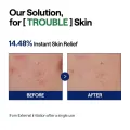 MEDIHEAL Teatree Calming Hydra Serum 40ml - Hydrating Soothing Facial Care 7