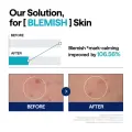MEDIHEAL Madecassoside Blemish Repair Serum with 2% Niacinamide, 40ml 7