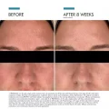 SkinCeuticals Discoloration Defense 30ml Daily Serum for Visible Dark Spots 6