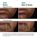 SkinCeuticals A.G.E. Interrupter Ultra Serum - 30ml Lifting Treatment 11