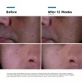 SkinCeuticals P-TIOX Peptide Cream for Wrinkles and Pore Refining, 48ml 5
